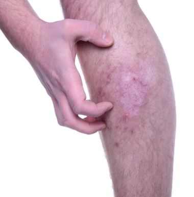 Itchy legs after shaving, get rid stop itching fast