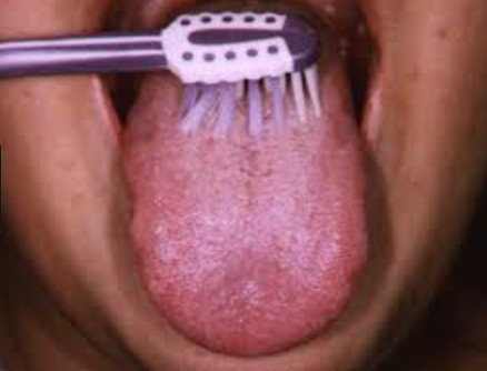 Brushing for Purple Tongue