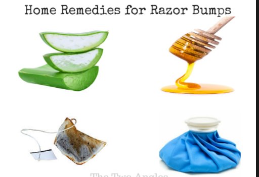 home cure for razor burn
