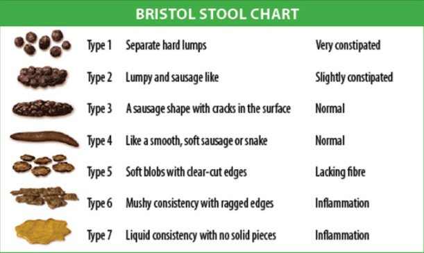 Stool color chart and stool colour meaning